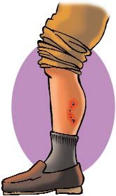  PRIMEROS AUXILIOS (65)  IMAGENES DIBUJOS JPG GALICIA